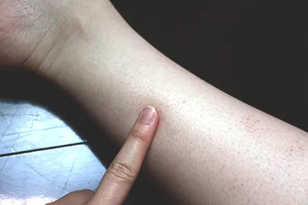 家庭用脱毛器の効果を実感するまでの期間と回数