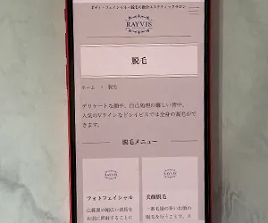 レイビス