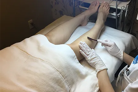 5. フレイアクリニックの脱毛機と施術方式｜メディオスターモノリスで痛みを軽減