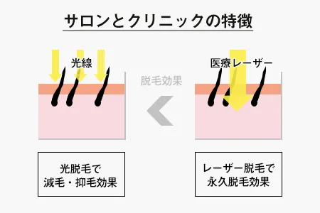 医療脱毛と脱毛サロンの違い。医療脱毛とは？