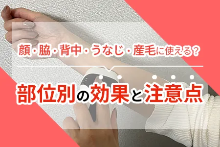 ケノンは顔・脇・背中・うなじ・産毛に使える？部位別の効果と注意点