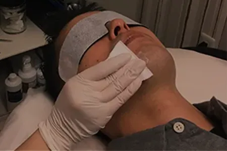 除毛クリームの仕組み｜髭に向かない科学的な理由