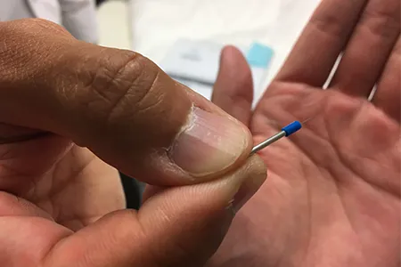 ヒゲ脱毛が痛いと感じやすい人の特徴