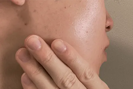 ヒゲ脱毛の痛みを和らげる具体的な対策