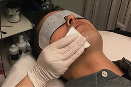 深剃りしても青髭が消えない理由