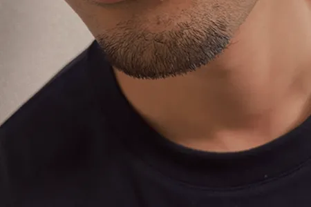 まとめ｜髭が濃い原因を知り、正しい対策を選ぶ