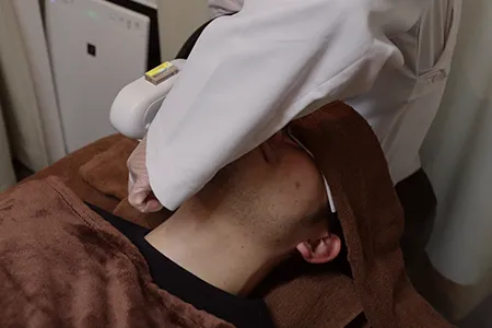 髭剃りで肌荒れを繰り返す人は「ヒゲ脱毛」で根本改善も可能