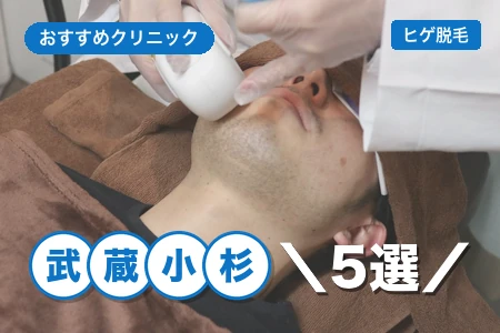 武蔵小杉でヒゲ脱毛おすすめ5選｜武蔵小杉駅近で安い院は？