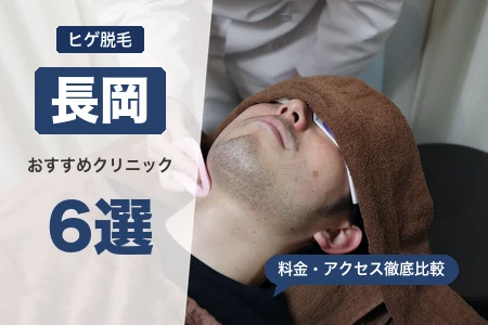 長岡でヒゲ脱毛おすすめ6選！長岡駅直結で安い医療クリニック比較