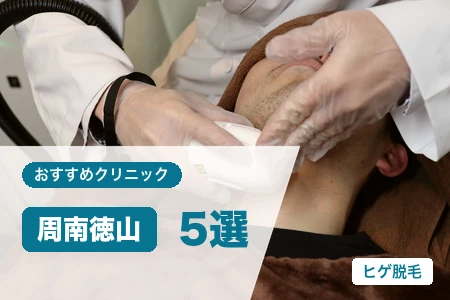 周南徳山でヒゲ脱毛が安いおすすめ5院！徳山駅ビル・5回48,000円で比較