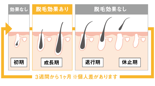 毛周期のサイクルと脱毛効果