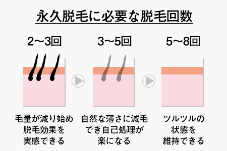 メンズのお腹(ギャランドゥ)の永久脱毛にかかる回数・期間